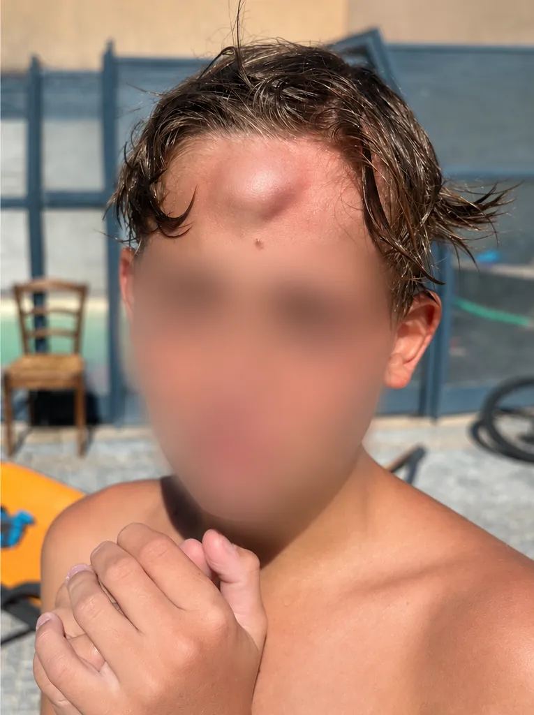 Le front de l'enfant, vu de face