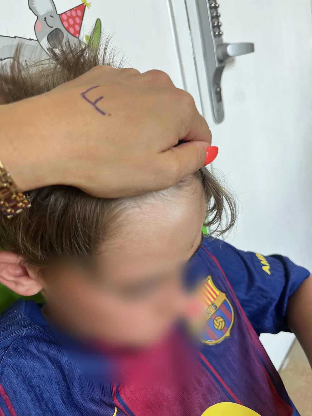 Une main posée sur le front d'un enfant après un choc
